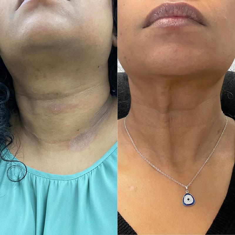 Glycolic Acid 7% Exfoliating Toner 240ML